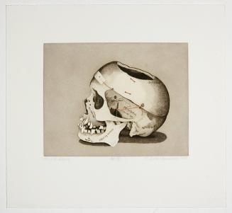 Dr. R.’s Skull (2nd State)