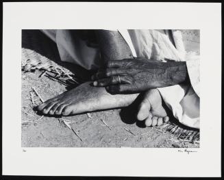 [Leathery feet, Kaduna, Nigeria]