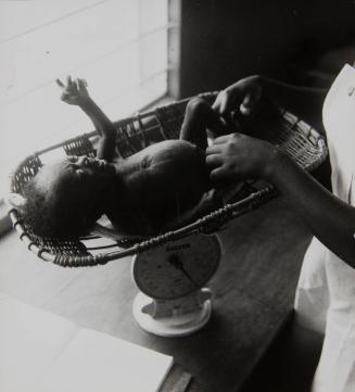 Underweight newborn on the scale (likely Ethiopia), Africa