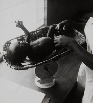 Underweight newborn on the scale (likely Ethiopia), Africa