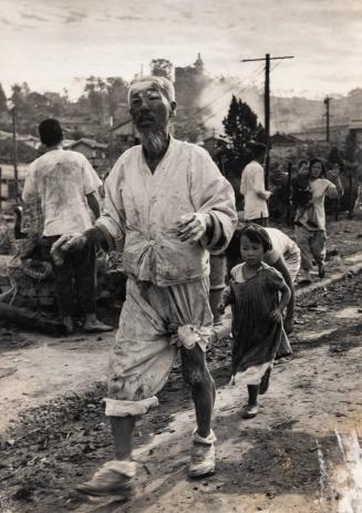 [Korean War: An Injured North Korean Man]